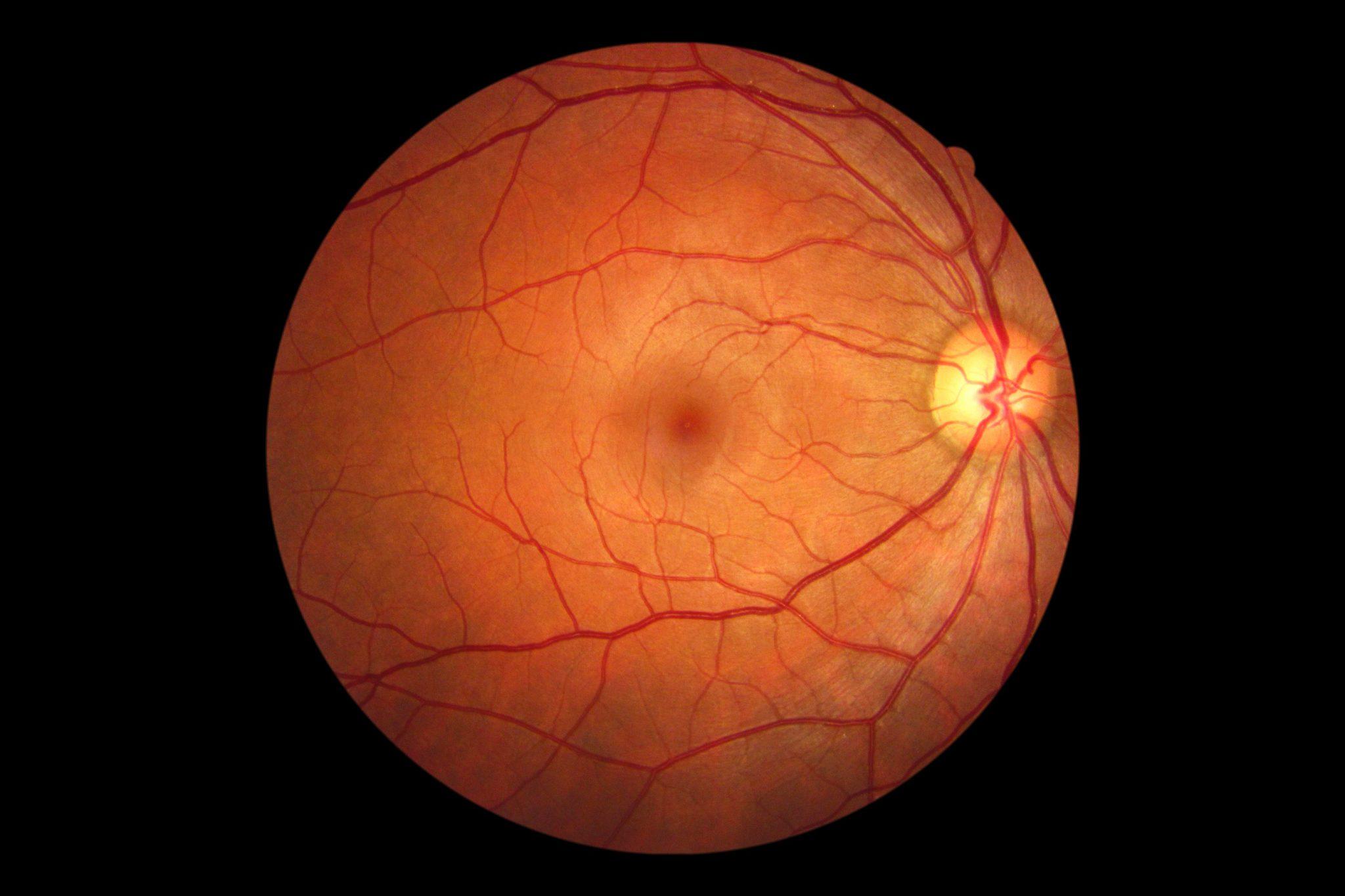 Unveiling the Science Behind Retinal and Its Anti-Aging Effects